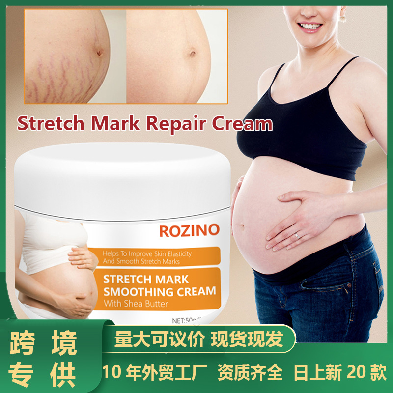Cross-Border Obesity Mark Repair Cream for Postpartum Pregnant Women to Fade and Prevent Obesity Marks, Tighten Belly and Remove, Available in Stock