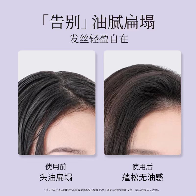 迪彩MTRUEは頭油に行って、長期的にオイルをコントロールします。|undefined