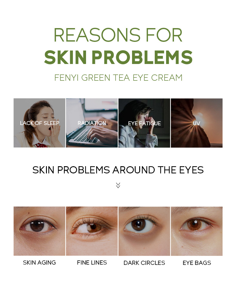FENYI Green Tea Eye Cream 30g hydrates and moisturizes the eye skin. Cross-border manufacturer wholesale in stock undefined
