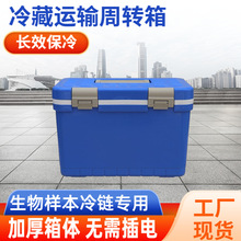 �t������ѪҺ�ӱ���朱�����܇�d��yʽ����\ݔ�����D��