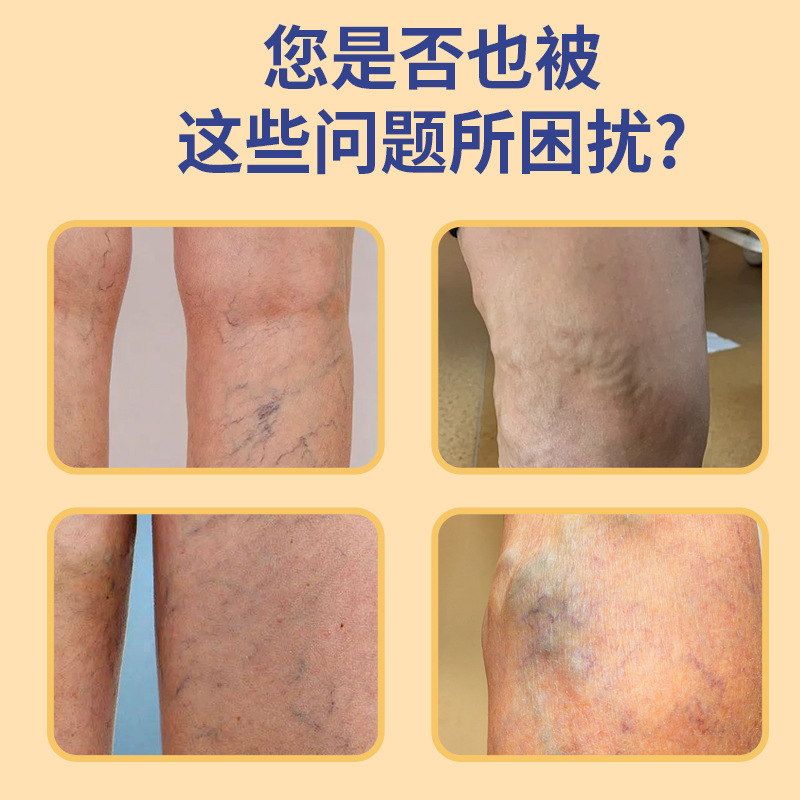 爆款香港大药房静脉舒膏 外用腿部不适蚯蚓腿草本药膏批发代发|undefined