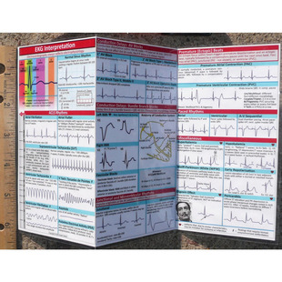 Cross-Border New Product Ekg Pocket Guide Ecg Pocket Guide