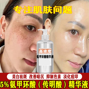 5%�����ᾫ�AҺ�ߝ�Ȱ��׭h����������ȥ���Sȥ��ɫ�����Һ���l