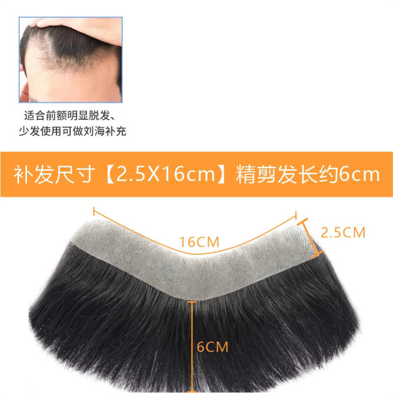 发际线假发贴假刘海假发片m形发际线贴男一片式前额补发自然真发|undefined