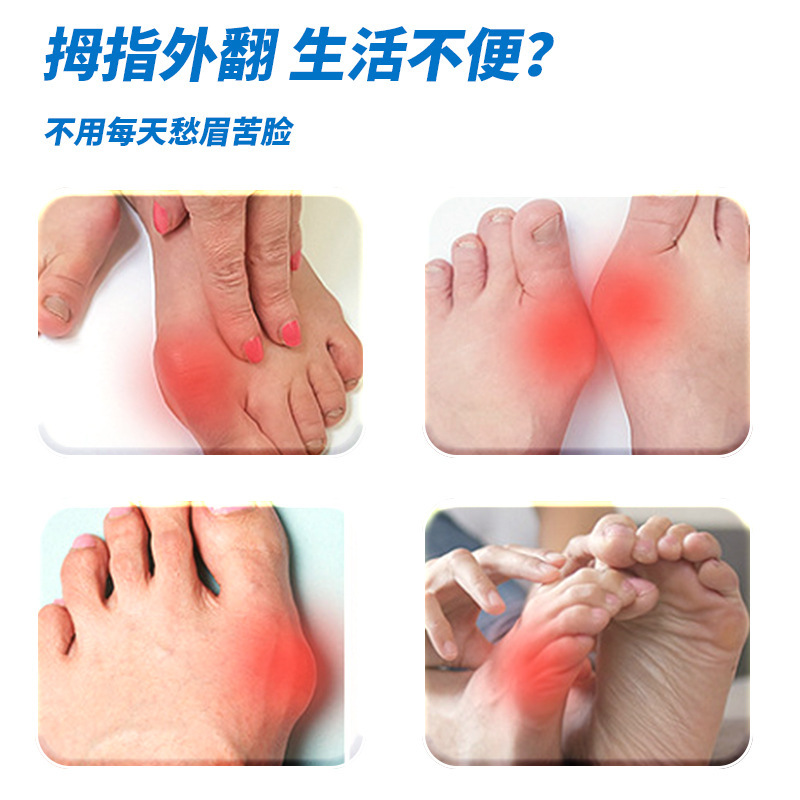 香港薬局 親指外反パッチ 関節突出パッチ 足指変形パッチ 足関節矯正パッチ|undefined