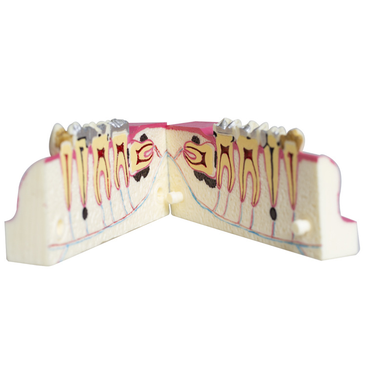 Modelo de descomposición del tejido del diente posterior inferior derecho de la cavidad oral del diente