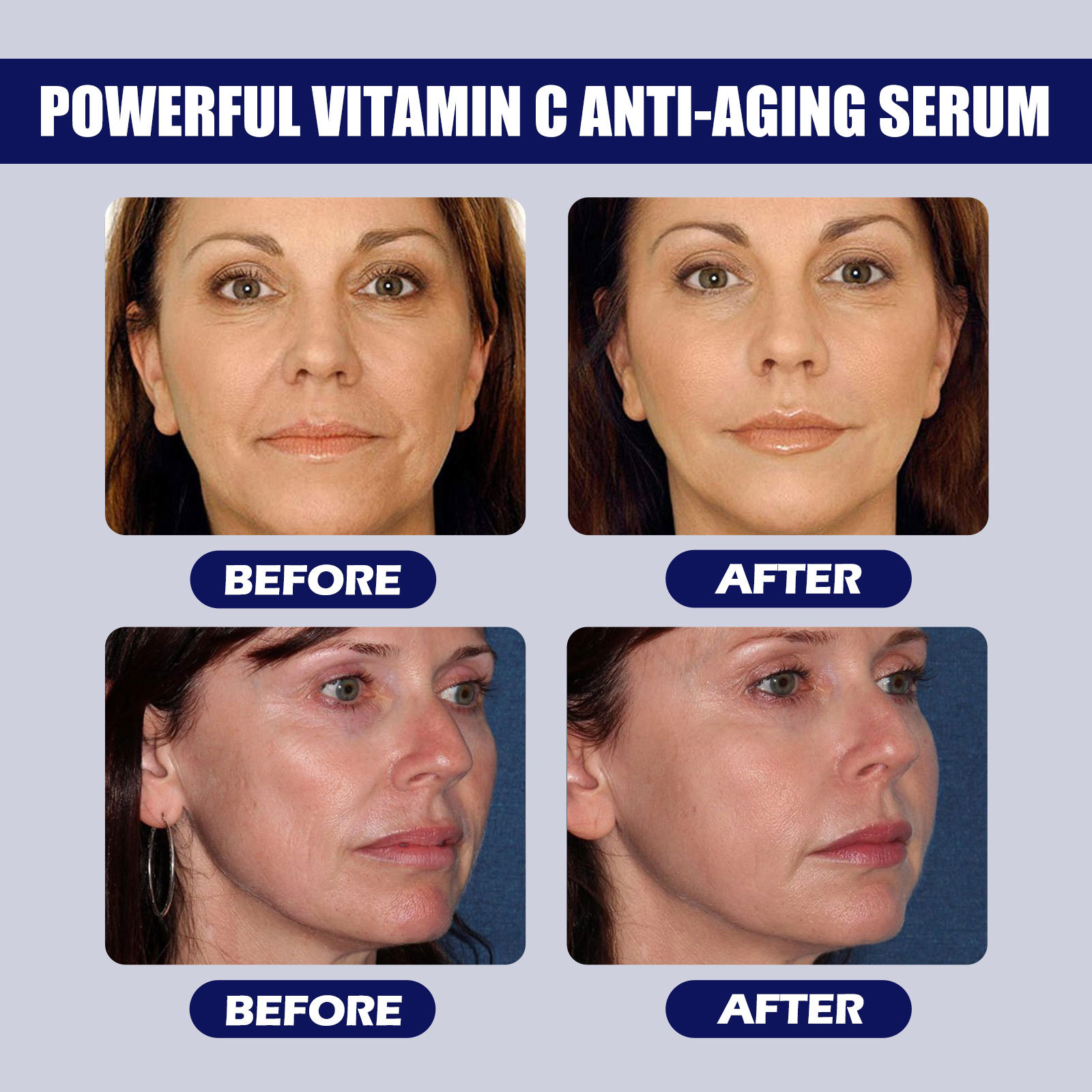 EELHOE Vitamin C Moisturizing and Moisturizing, Lightening Fine Lifting Head Lines, Firming Skin, Anti aging essence_voghion.com