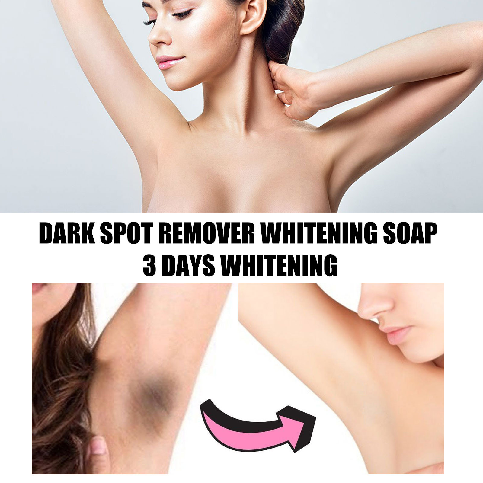 Dark Spot Remover Whitening Soap For Body Knees And Elbows_voghion.com