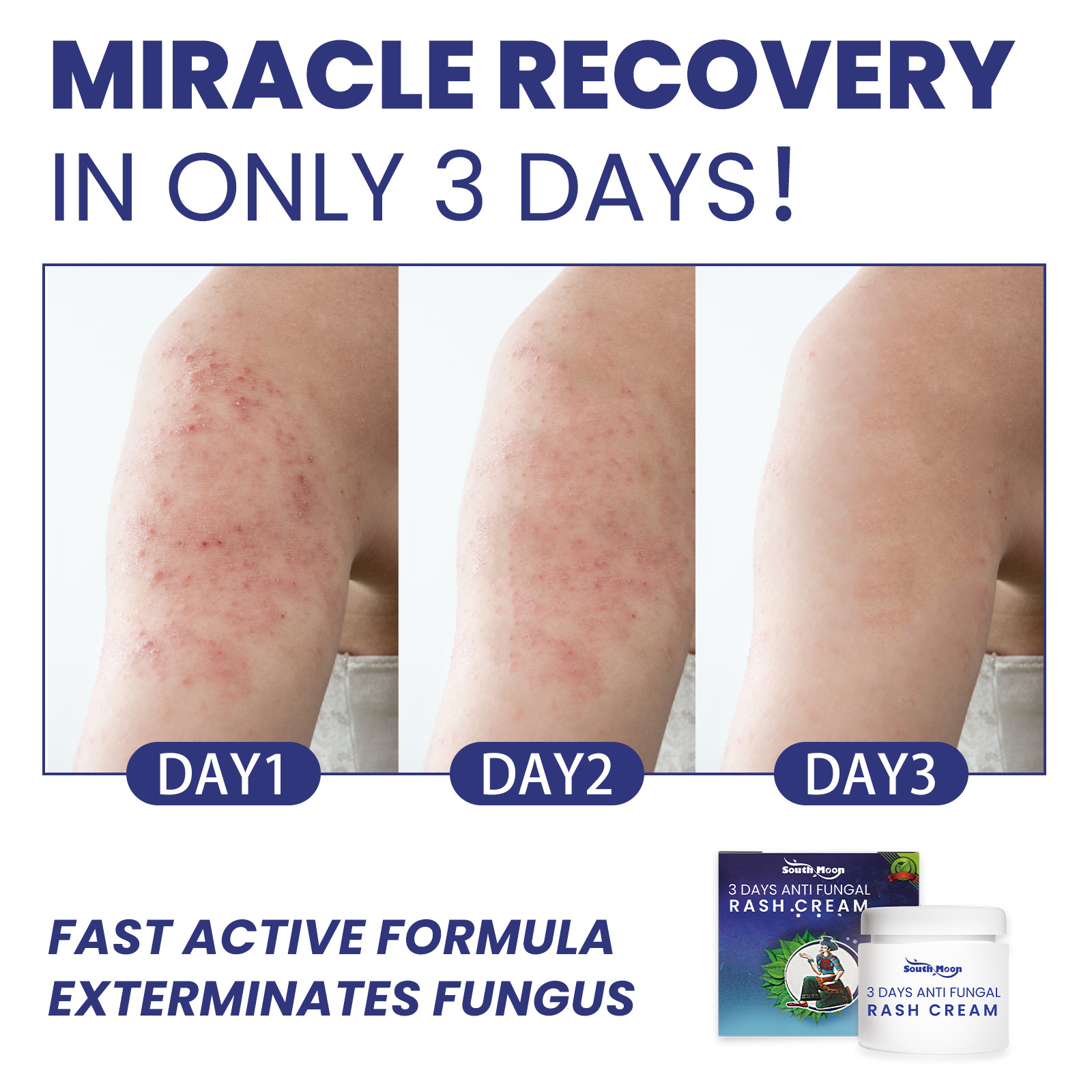 South Moon Skin Repair Cream herstelt de moshuidbarrière, verlicht roodheid en jeuk, hydraterende huidcrème_voghion.com