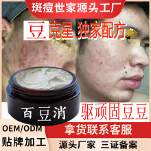 特号qu豆膏淡化豆印青春痘粉刺控油qu豆男女脸部痘坑老中医qu豆