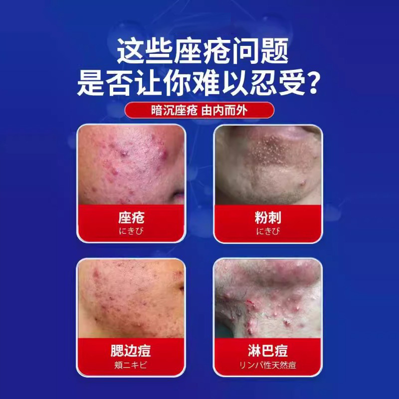岩井昃弘重度暗疮玫瑰痤疮药膏祛痘脸上下巴起痘痘屏障修护专用膏|undefined