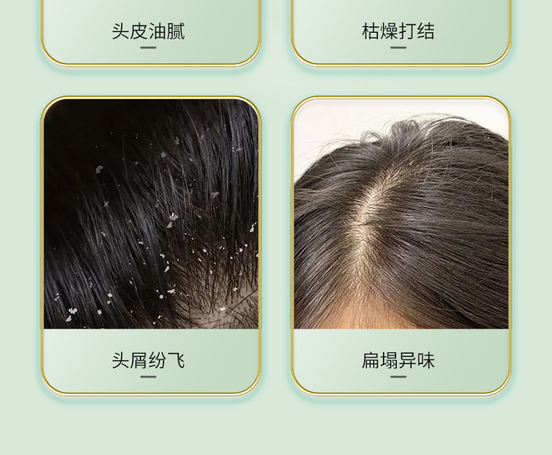 Handmade Wusiman Grass Five Black Hair Care Shampoo Soap with Cacumen Platycladi and Polygonum Multiflorum for Deep Cleansing key features