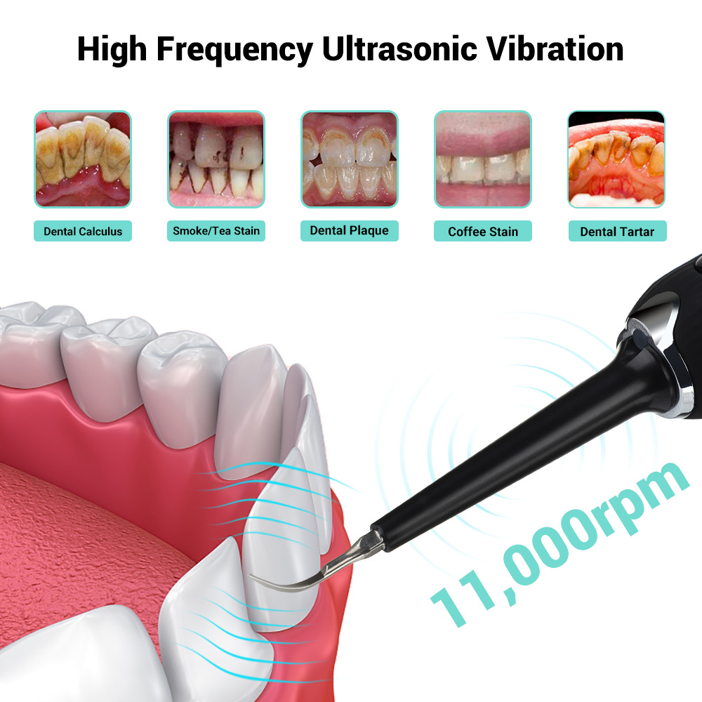 Ultrasonic Toothbrush Image 1