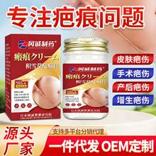 �eѩ�ݰ̺۸��ʸ��a�����̺۶�ӡ�̺�Ƥ�w�g���o��TĨ�����o����