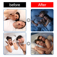 South Moon Snore Patch, Closed Mouth Sleep Aid Patch for Adults, Anti-Gaping Mouthpiece for Snoring and Breathing