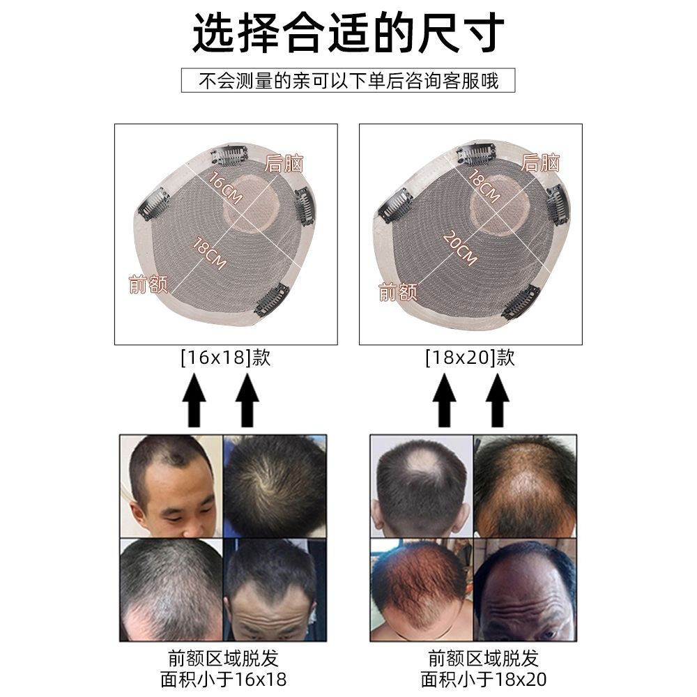 假髮男短髮毛寸全真發無痕隱形假髮片男士可粘可卡輕薄頭頂補發片