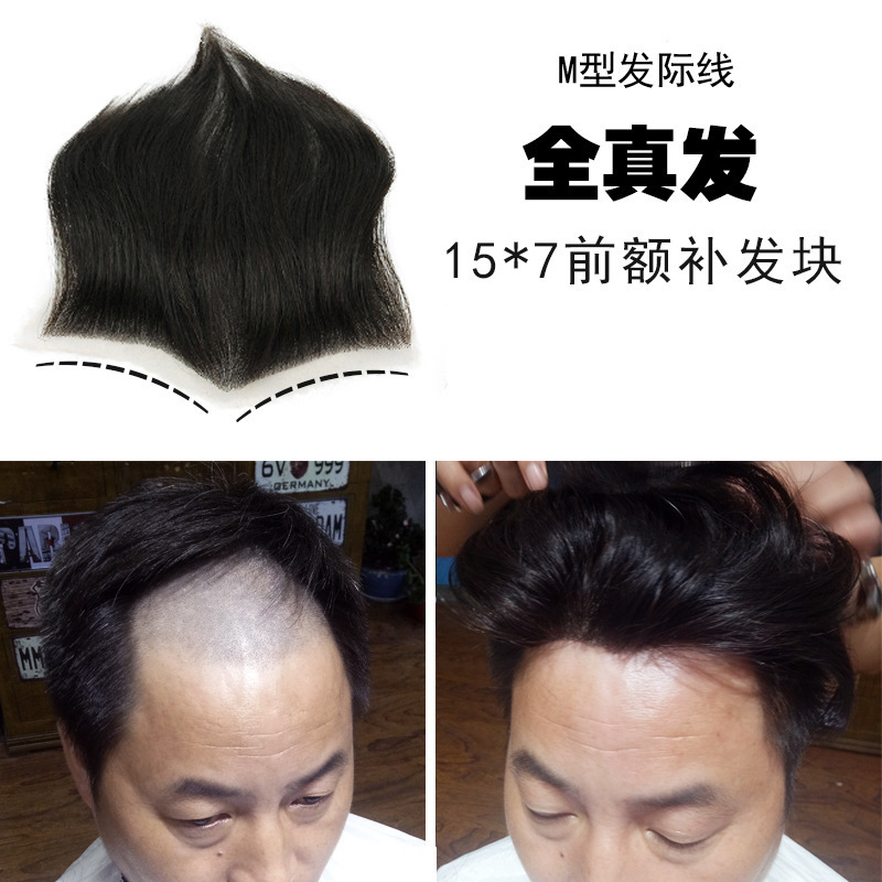 Men's head replacement block 15*7 forehead replacement wig large back head men's hairline wig block