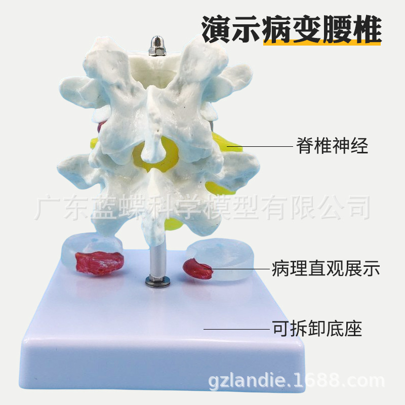 ���弹��ģ�ͼ�׵����׵ģ�� ��׵�ṹ��׵���� �ؽ�ģ�߲�����׵