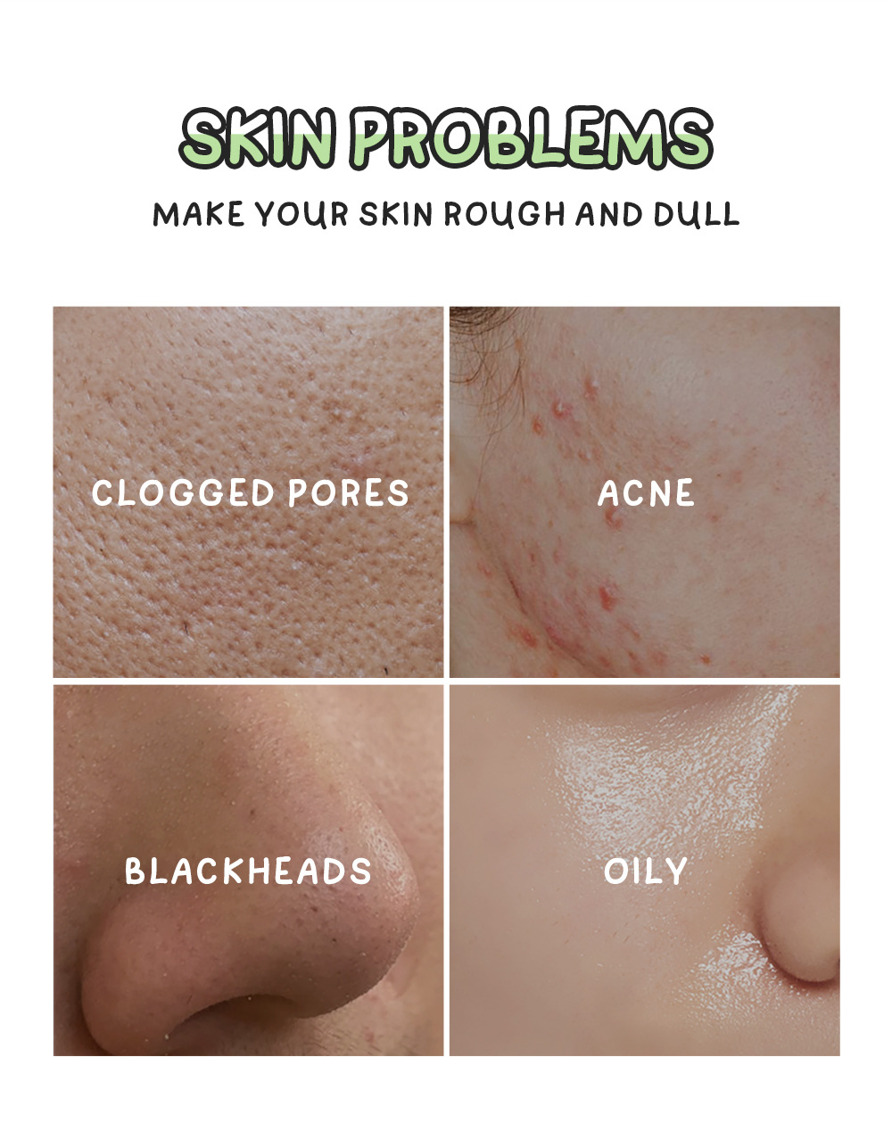 Cross-border fenyi Green Tea Mud Mask 100g(Indonesian Version) Cleansing, Hydrating and Moisturizing Skin Care Product Manufacturer in stock undefined