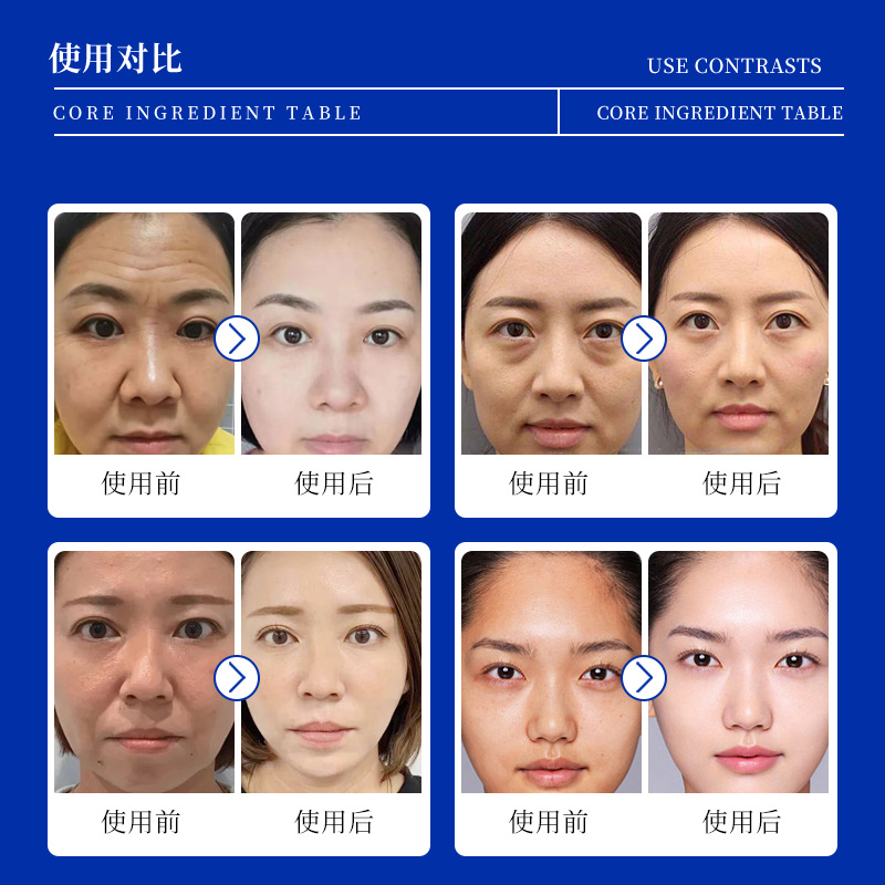 Polypeptide Time Anti-Wrinkle Cream Anti-wrinkle Firming Repair Fine Lines Moisturizing Rejuvenation Beauty Salon Human Source Restructured Collagen Cream