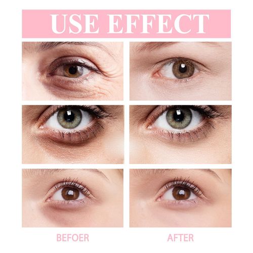 EELHOE Retinol Eye Cream Stick Moisturizes, firms and tightens eye skin, improves fine lines, crow's feet, dark circles