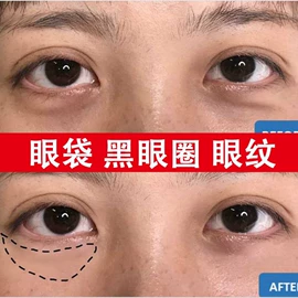液态精华;面霜;涂抹面膜