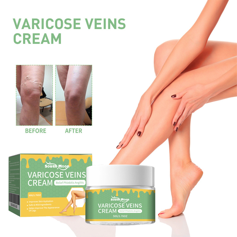 South Moon Vein Repair Cream Leg Massage Relieve Pain Earthworm Leg Vein Care Cream Repair