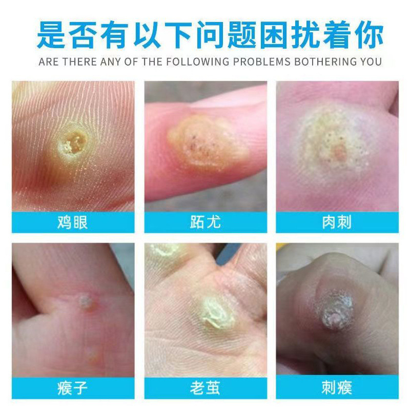 南京同仁堂緑金家鶏尤康子鶏繭膏肉刺|undefined