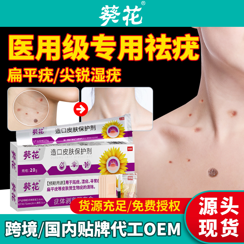 Gel de remoção de verrugas de grau médico de girassol, creme de remoção e descamação de verrugas, verruga plana especial, verruga filamentosas, verruga plantar, verruga genital