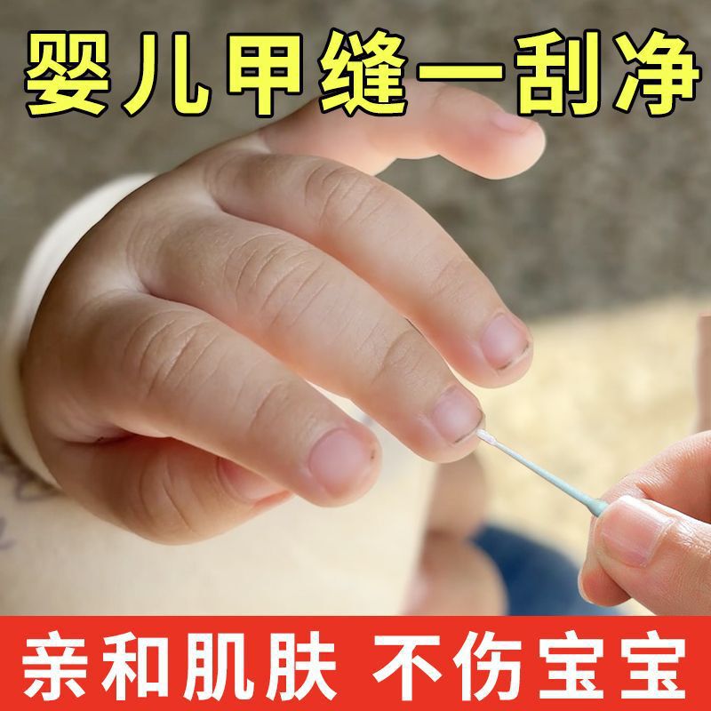 Nail Gap Dirt Cleaner Baby Nail Gap Dirt Cleaning Tool Nail Gap Dirt Cleaning Stick Does Not Damage Nails Nail Gap Dirt Cleaner Baby Nail Gap Dirt Cleaning Tool Nail Gap Dirt Cleaning Stick Does Not Damage Nails