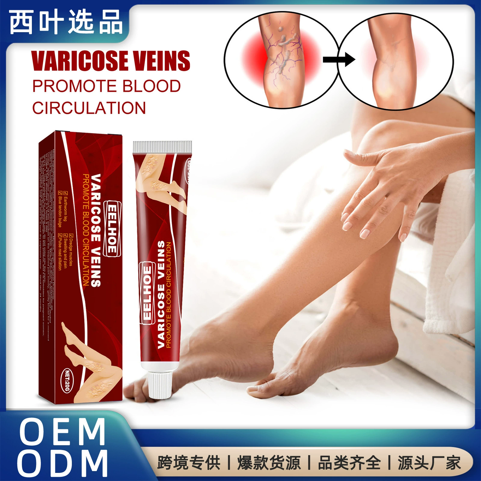 Внутривенный массаж EELHOE для снятия сосудистых выпуклости сосудов ног варикозный крем отек икры отек дождевого червя массажный крем для вен ног