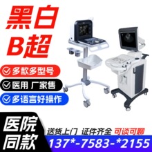 床旁移动B超仪 B超机彩超机价格-B超机徐州一贝报价  /一贝厂家