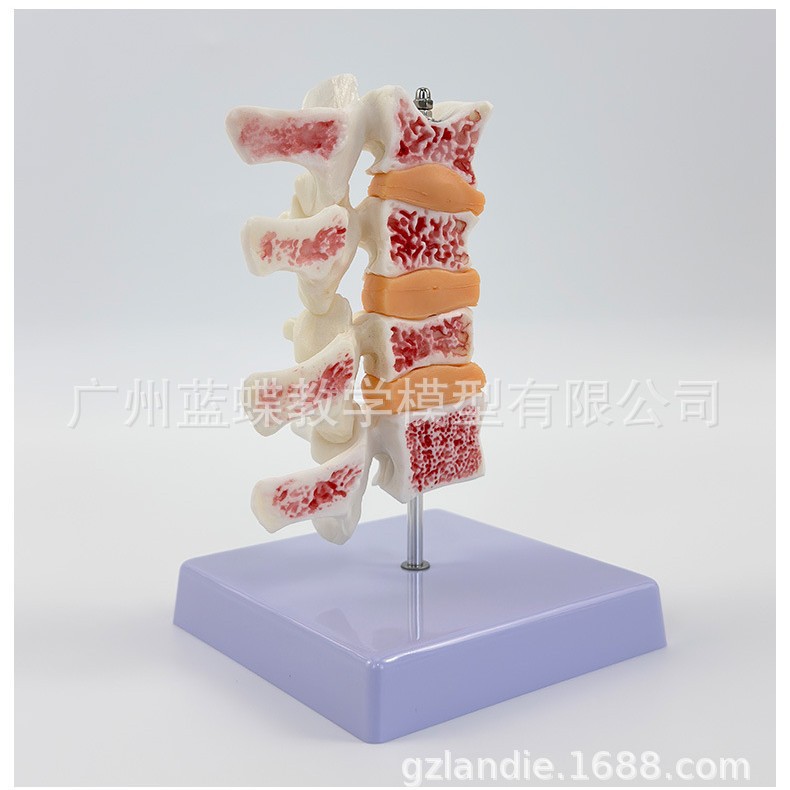 ��������ģ�� ��׵���Ͳ���ģ�� ���弹׵ģ�� ��������ģ��