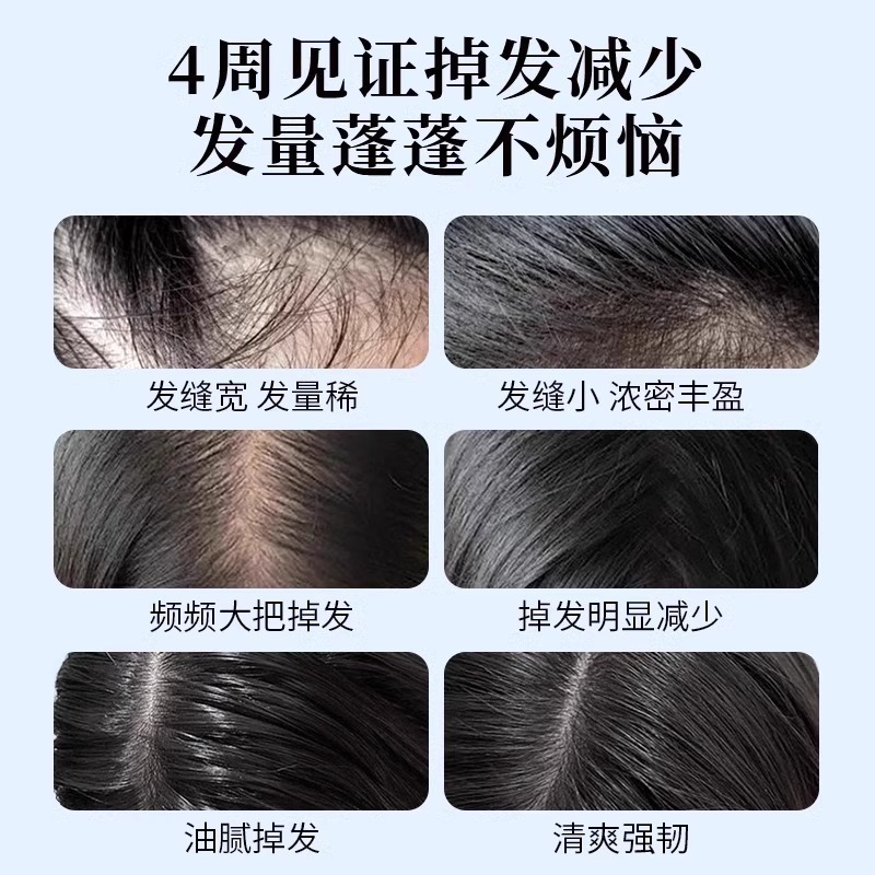ehd洗发水控油蓬松去屑止痒香水型持久固发防脱洗发水正品500ml|undefined