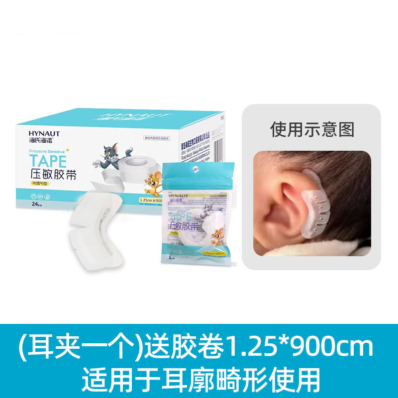 婴儿耳廓辅助器宝宝耳朵定型贴招风耳塑形新生儿硅胶带耳畸形耳撑|undefined