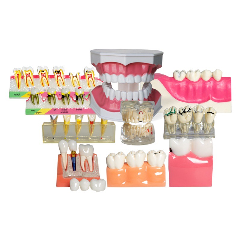 Modelo dental molde modelo dental modelo de enseñanza dental removible dentadura oral cepillado Preparación del diente modelo resina