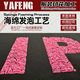 ���ްl�ݹ�ˇ�D���ƽz�Wӡ�����aֱ��T���и��Lins����ϵ���ƶ���