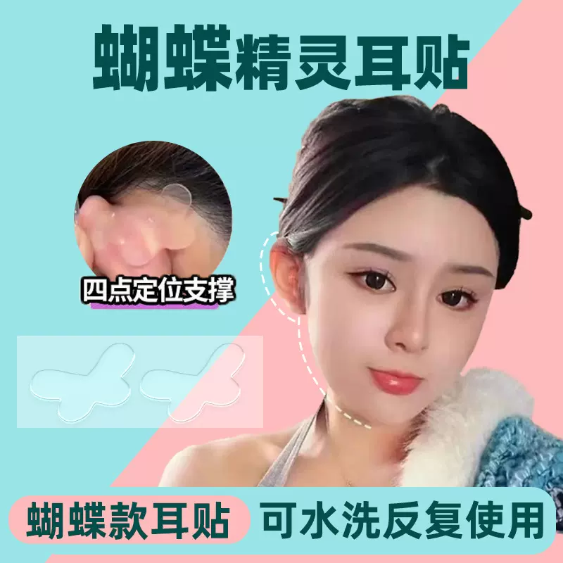 蝴蝶型精灵耳贴面耳变招风耳矫正耳贴立异型耳贴拍照定型大脸显小