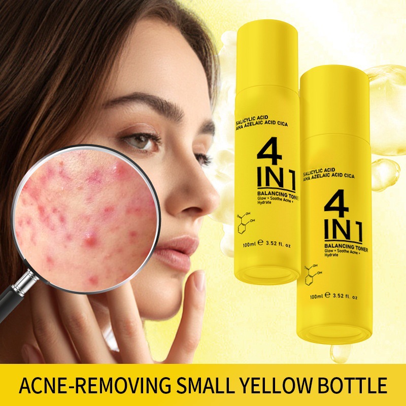 跨境专供4合1祛痘精华水抗痘去痘印外贸改善油痘肌闭口粉刺爽肤水