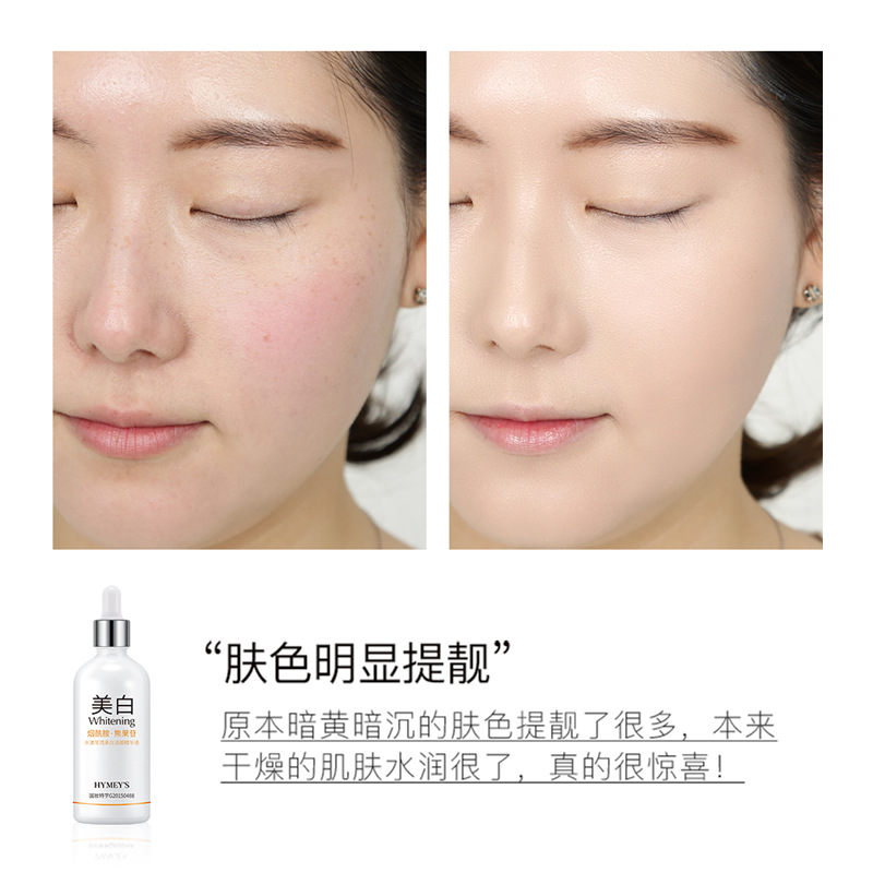 Sérum Facial Blanqueador de Manchas, Hidratante, para Cuidado Facial