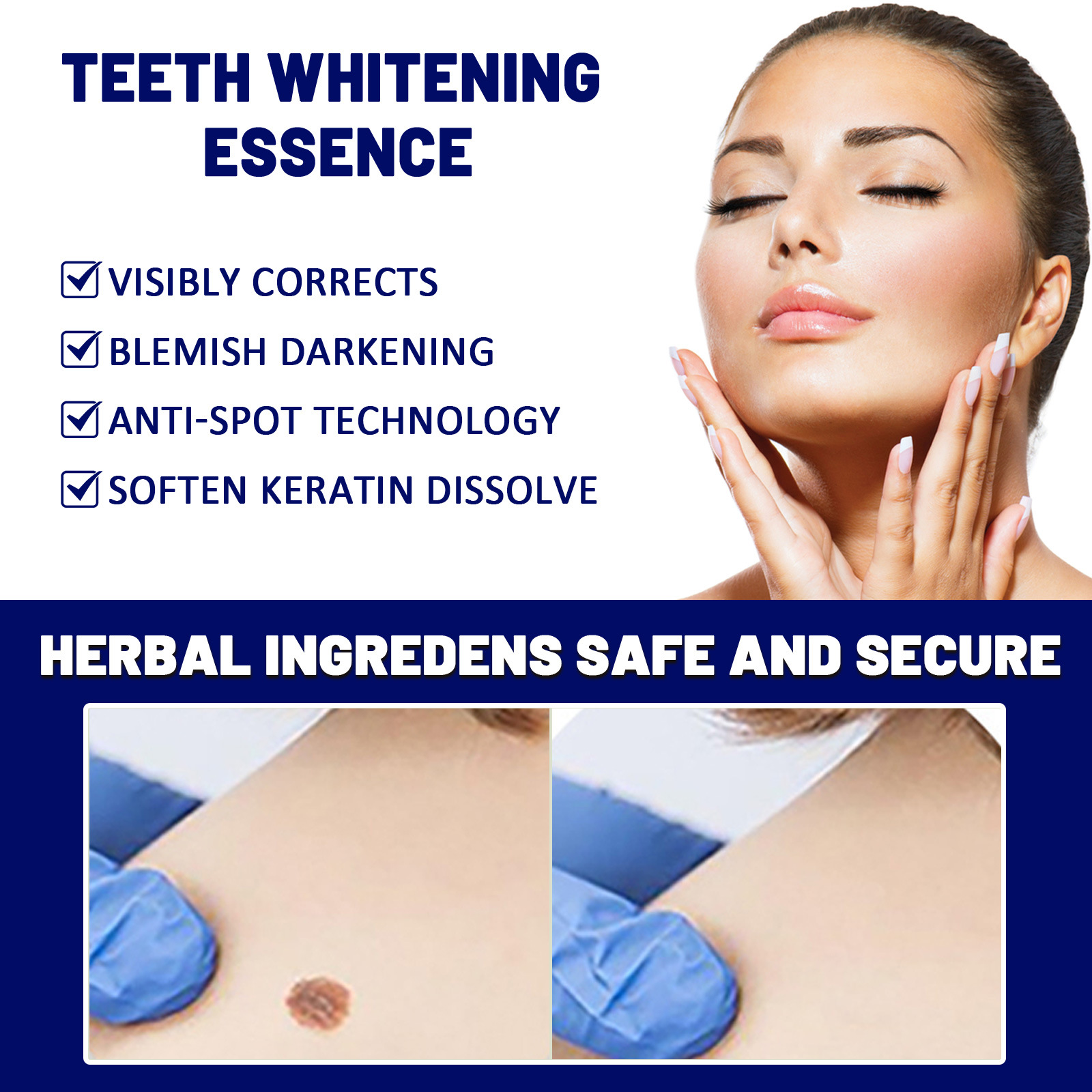 2023 Skin Label Borttagning Kyckling Ögonvård Rengöring Hud, kropp, ansiktsbehandling Flat Youke Wart Cream_voghion.com