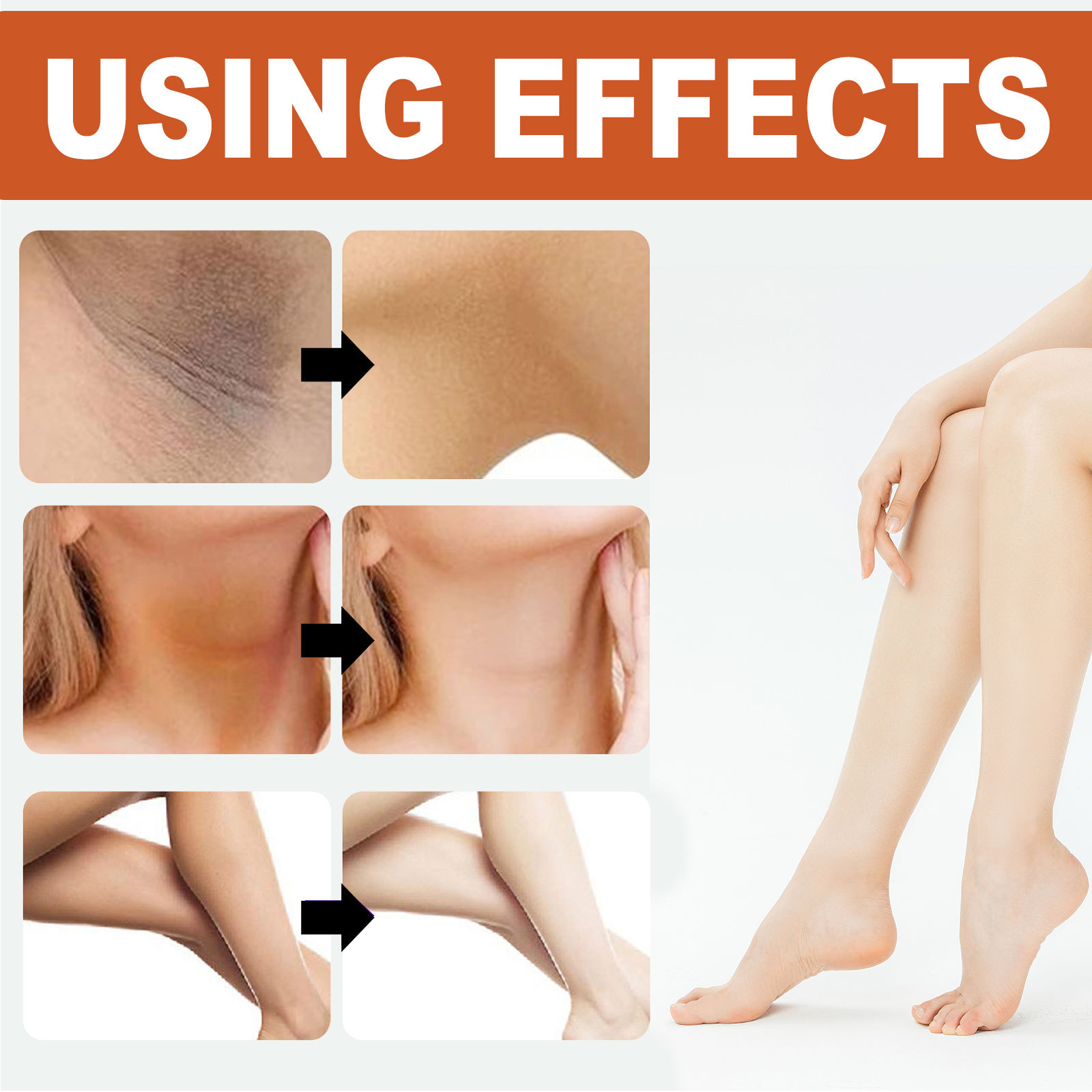 Repararea punctelor negre de la mars pentru axile, gât, articulații mână-picior, iluminarea nuanței pielii și înfrumusețarea corpului_voghion.com