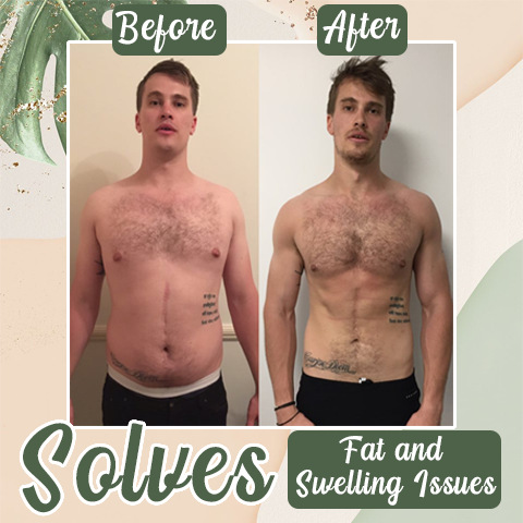 Herbal Blood Sugar Patch