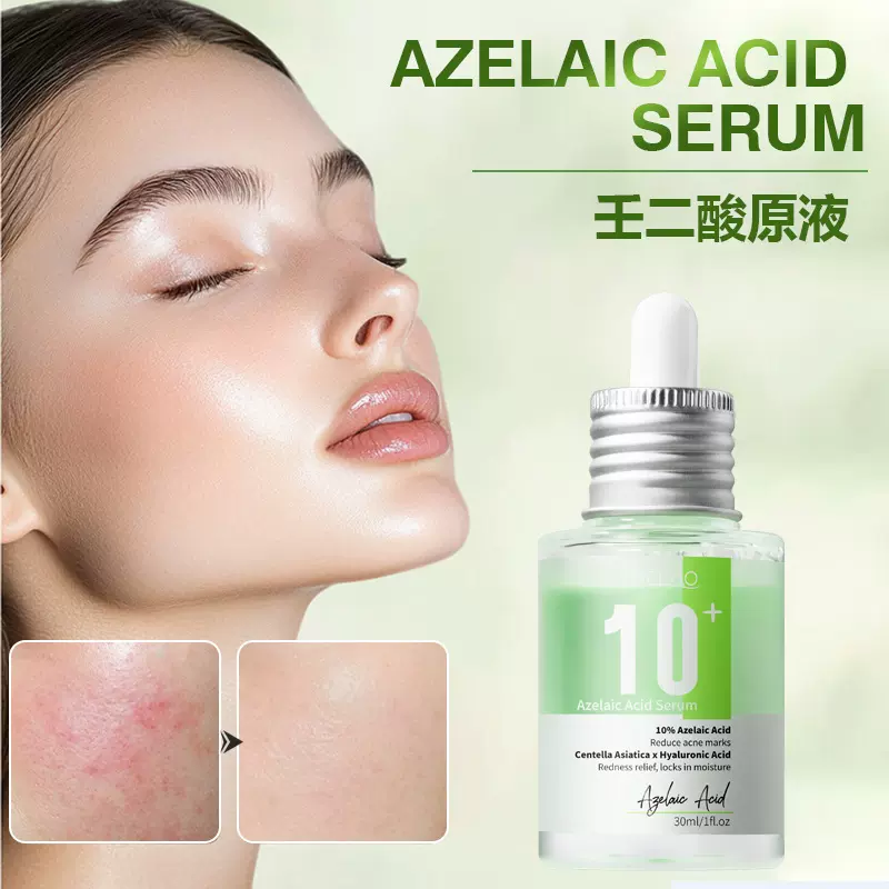 跨境10%壬二酸+透明质酸原液面部护理焕白保湿修红壬二酸精华液