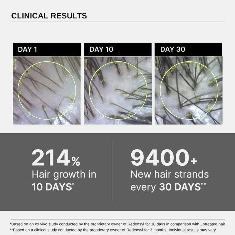 跨境爆款迷迭香男女高级头发生长精华Advanced Hair Growth Serum|undefined