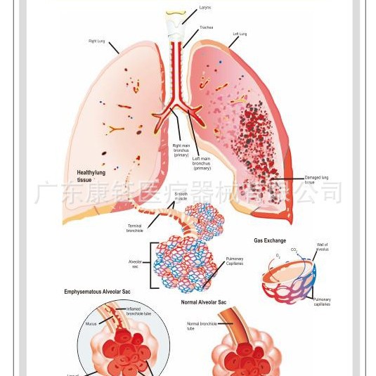Emfisema 16
