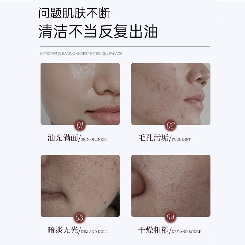 LVFEI glaciar barro limpiador de piel rejuveneced loción limpiadora suave piel rejuveneced control de aceite hidratación espuma fino fabricante image 3