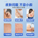 Beijing Tongrentang Medical Moist Liquid Dressing Repairs Skin Barrier and Improves Acne Dermatitis Eczema Bacteriostasis