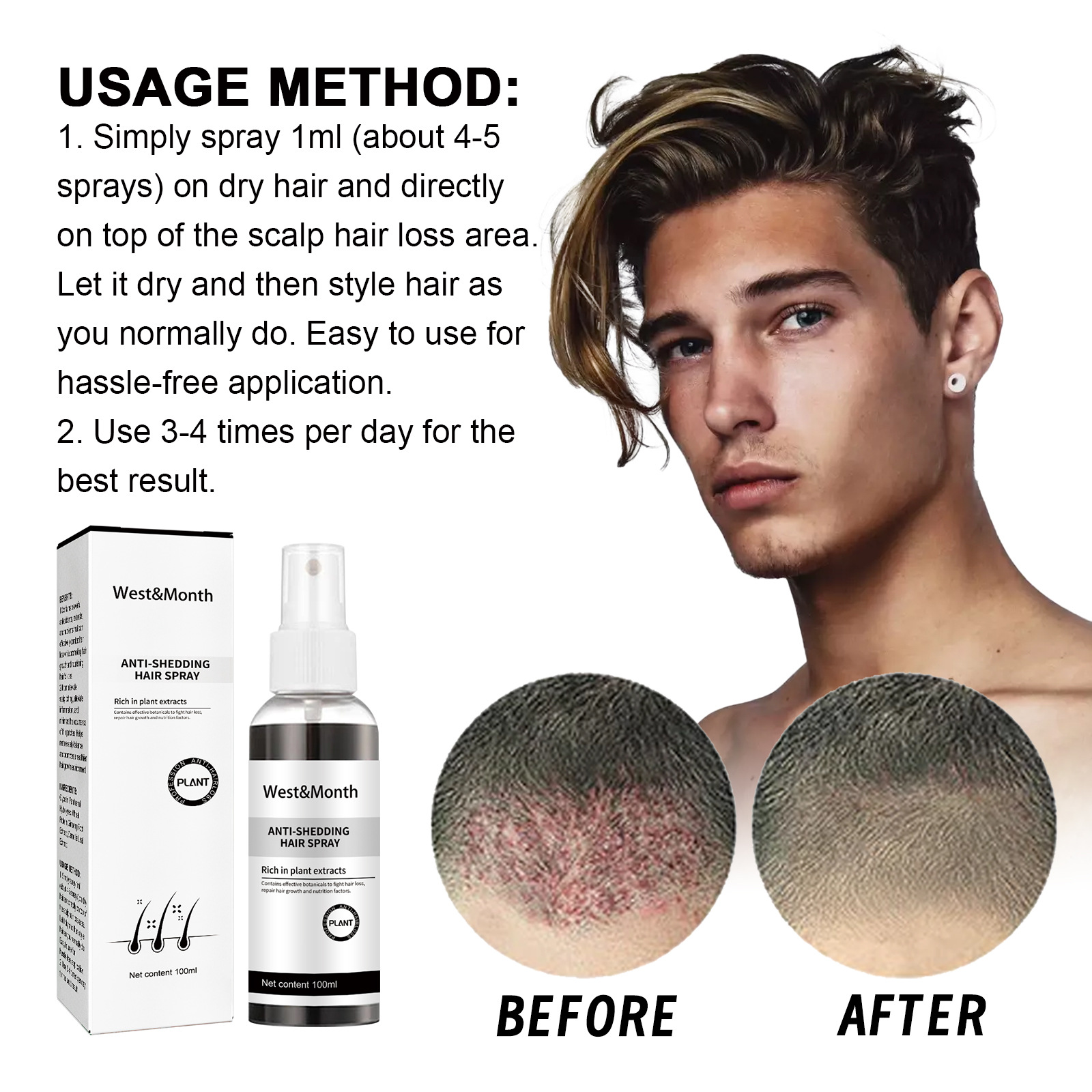 West&Month anti loss spray improves hairline density, strengthens hair, nourishes root, moisturizes hair_voghion.com