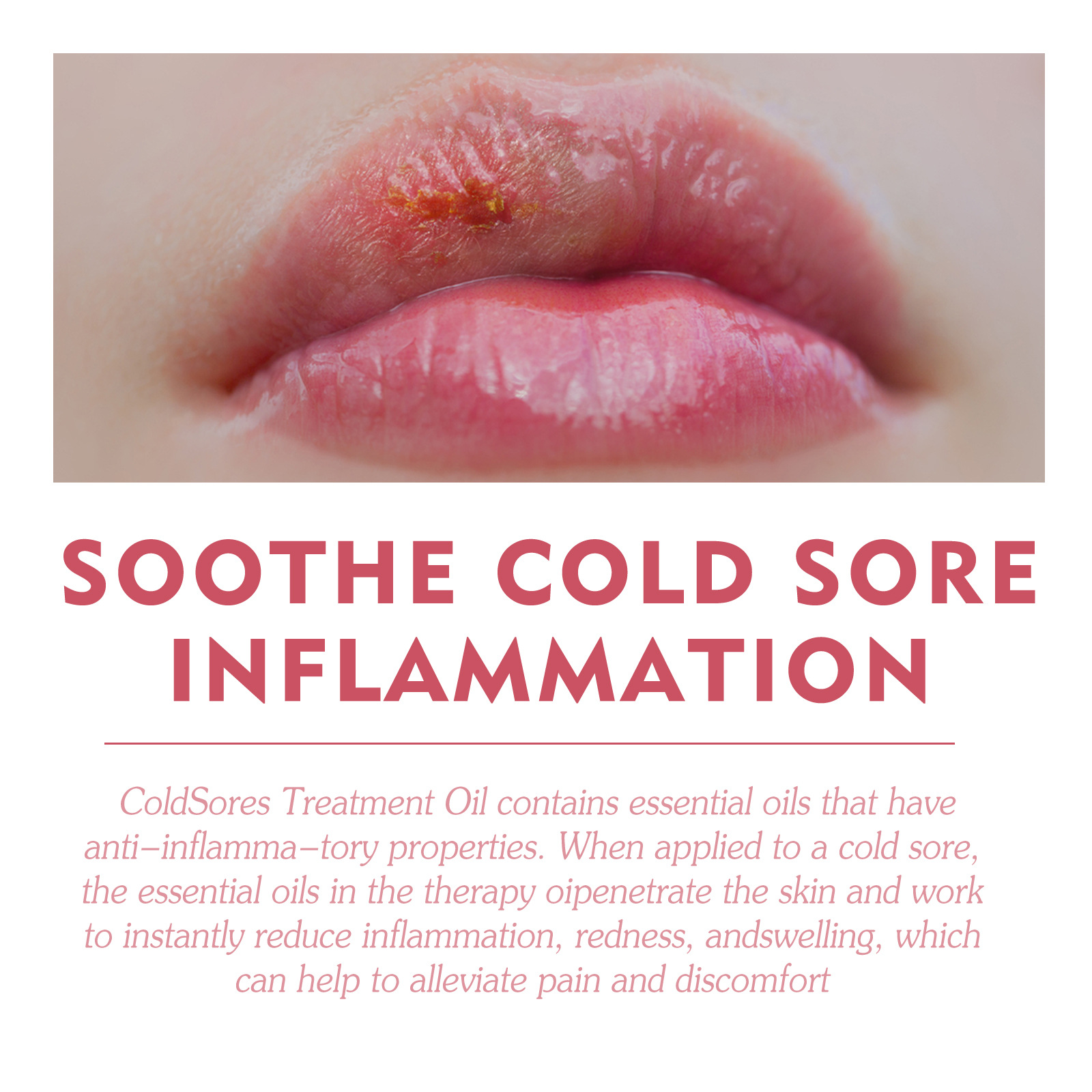 Soin des lèvres essence liquide hydratant anti-gerçures_voghion.com